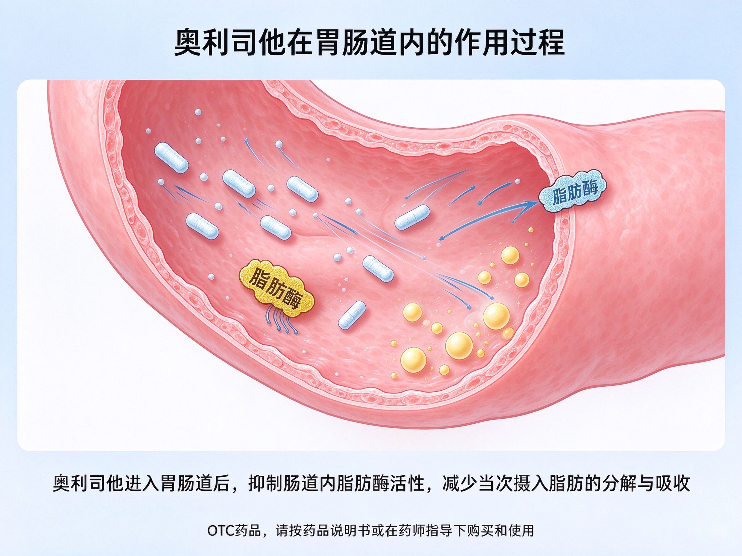 奥利司他排油反应,漏油尴尬应对,油性便科普,减脂副作用误区,赛乐赛客服答疑